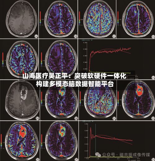 山海医疗吴正平:突破软硬件一体化 构建多模态脑数据智能平台-第1张图片