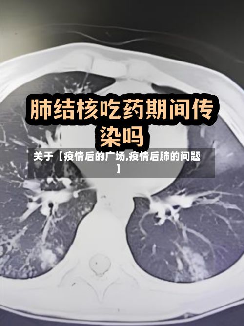 关于【疫情后的广场,疫情后肺的问题】-第1张图片